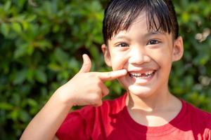 little girl showing her broken milk teeth photo