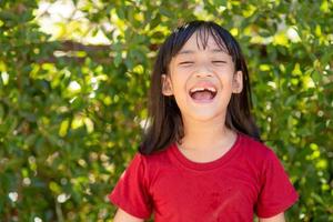 little girl showing her broken milk teeth photo