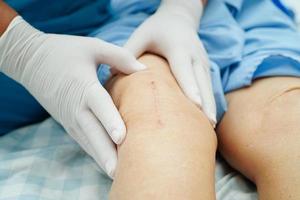 Doctor checking Asian elderly woman patient with scar knee replacement surgery in hospital. photo