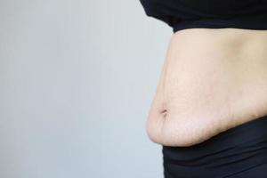 mujeres embarazadas que resultan en grasa y cicatriz de la piel del vientre rayada foto