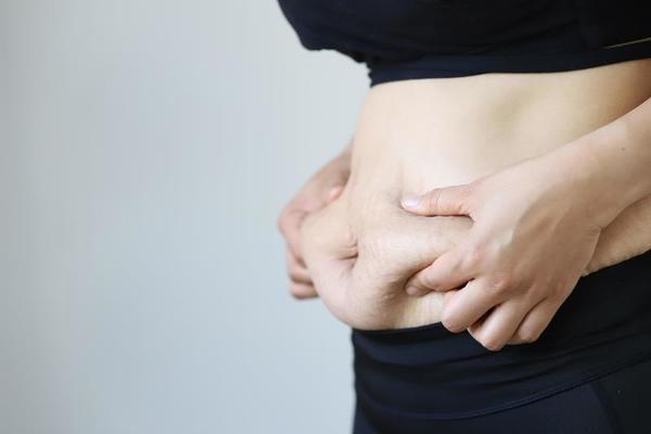 Pregnant women resulting in striped belly skin Fat and scar 13094501 Stock  Photo at Vecteezy