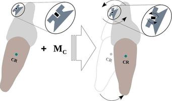 Torque experienced by a tooth due to the torque in the Bracket slot vector