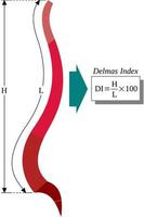 Delmas Index or relationship between the length to the height of the spine vector