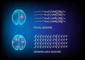 ilustración de los tipos de convulsiones demostradas por el inicio y las ondas cerebrales en el contexto tecnológico. vector