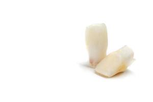 dientes de leche sobre un fondo blanco. pérdida de dos dientes inferiores del niño en la etapa de formación de la mandíbula. foto