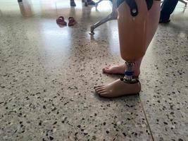 BK disability using and training leg prothesis photo