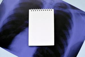 X-Ray film image of human chest for a medical diagnosis and empty blank notepad page on blue hospital table. Flat lay top view photo