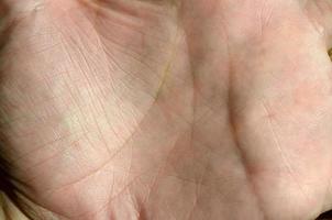 Close up of human hand skin with visible skin texture and lines photo