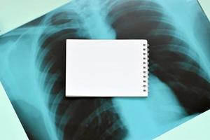 imagen de película de rayos X del tórax humano para un diagnóstico médico y página de bloc de notas en blanco vacía en la mesa azul del hospital. vista superior plana foto