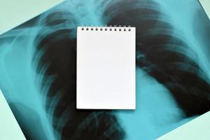 X-Ray film image of human chest for a medical diagnosis and empty blank notepad page on blue hospital table. Flat lay top view photo