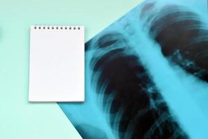 X-Ray film image of human chest for a medical diagnosis and empty blank notepad page on blue hospital table. Flat lay top view photo