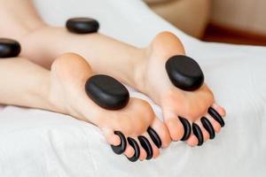 Hot stones lying on female feet photo