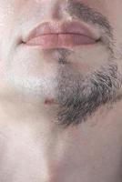 A cut on a man's chin from a sloppy shave. photo