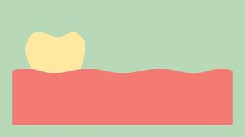 dente amarelo para branco, clareamento dos dentes e conceito de cuidados de saúde dental - estilo plano de vetor de desenho dental render animação de filmagem 2d, em formato de vídeo de ultra alta definição 4k e uhd 3840x2160 video