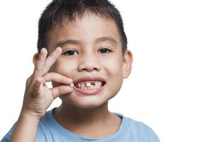 close up boy kid with opened mouth pointing at missing front baby tooth with finger smiling excitedly in on white background photo