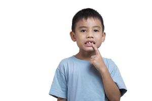 niño perdió dientes niño sin dientes apuntando con el dedo a la boca mostrando la brecha de los dientes foto