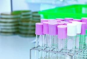 glass tubes on table in laboratory photo