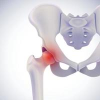 3D illustration of anterior view of hip bone showing painful position on white. vector