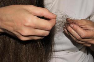 A girl with long dark hair holds a bunch of fallen hair in her hands. Hair loss problem. photo