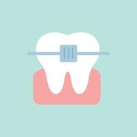 White tooth in a bracket system. Vector illustration