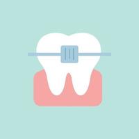 White tooth in a bracket system. Vector illustration