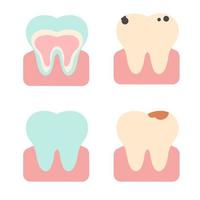 conjunto vectorial de dientes en diferentes estados. ilustración plana vector