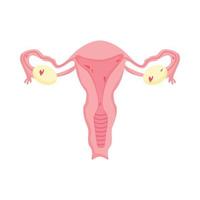 Female genitals. Endometriosis, vector illustration