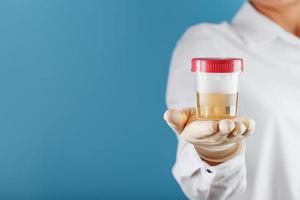 A doctor in a white coat holds a plastic container with yellow urine in his hand. photo