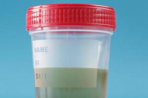 A container for biomaterials with a urine analysis and a red lid on a blue background. photo