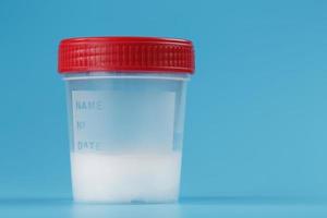 Semen in a test container with a red lid on a blue background. photo