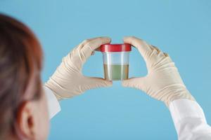 The doctor's gloved hand holds a transparent container with a urine test. photo