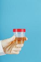 A container for biomaterial with a urine analysis in the hand of a doctor in a white rubber glove on a blue background. photo