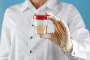 The doctor is holding a plastic can of urine for analysis. photo