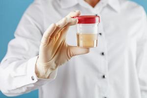 A doctor in a white coat holds a plastic container with yellow urine in his hand. photo