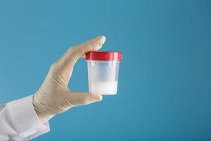 The doctor holds a plastic jar of semen in his hand for analysis. photo