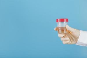 un recipiente para biomaterial con un análisis de orina en la mano de un médico con un guante de goma blanco sobre un fondo azul. foto