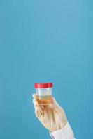 un recipiente para biomaterial con un análisis de orina en la mano de un médico con un guante de goma blanco sobre un fondo azul. foto