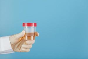 The doctor's gloved hand holds a transparent container with a urine test. photo