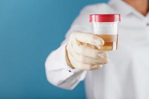 The doctor is holding a plastic can of urine for analysis. photo