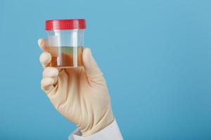 The doctor's gloved hand holds a transparent container with a urine test. photo