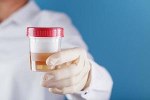 The doctor is holding a plastic can of urine for analysis. photo