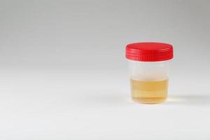 Urine in a jar with a red lid for laboratory analysis on a white background. photo