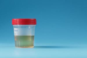 A container for biomaterials with a urine analysis and a red lid on a blue background. photo