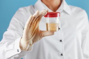 The doctor is holding a plastic can of urine for analysis. photo