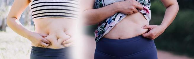 hermosa mujer gorda con cinta métrica usa su mano para exprimir el exceso de grasa que está aislado en un fondo blanco. ella quiere perder peso, el concepto de cirugía y descomponer grasa bajo el foto