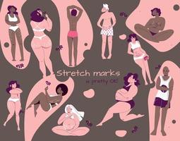 Stretch Marks Flat Background vector