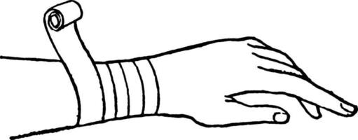 Bandaged hand, vintage illustration. vector