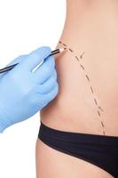 Sketching body before surgery. Cropped image of female torso and doctors hand in protective glove sketching her hips while isolated on white background photo