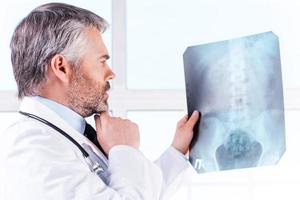 médico que examina la radiografía. un médico de cabello gris maduro y pensativo que examina la imagen de rayos X y sostiene la mano en la barbilla mientras está de pie aislado en blanco foto