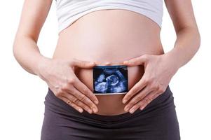 Expectation. Cropped image of pregnant woman holding x-ray image of baby while standing isolated on white photo